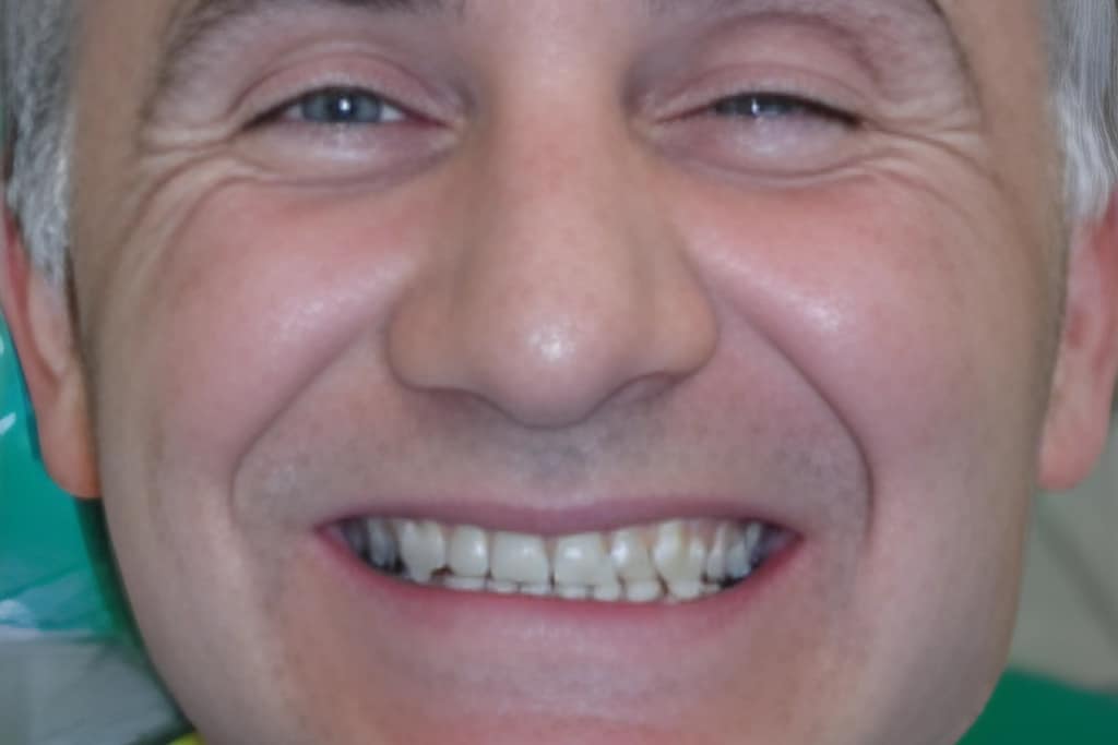 <span class="bt_bb_before_after_image_before_text">Before</span>