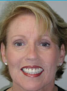 pat_caldwell-193x300 https://www.dentalimplantscr.com/wp-content/uploads/2012/11/pat_caldwell-193x300-1.jpg
