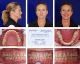 Patricia-Kodish https://www.dentalimplantscr.com/wp-content/uploads/2013/10/Patricia-Kodish.jpg