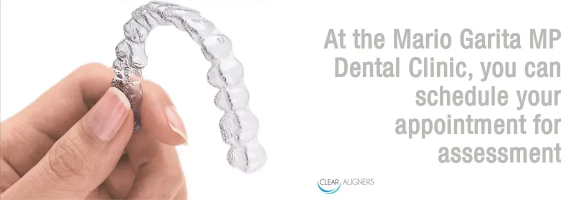 https://www.dentalimplantscr.com/wp-content/uploads/2019/06/clear-aligners-01.webp