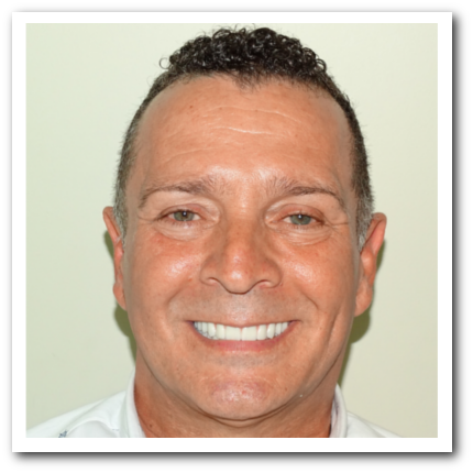 Lincoln Pantoja, from new Jersey get a brand new smile at Mario Garita MP Dental Clinic, with USA quality, but less than 60 % cost