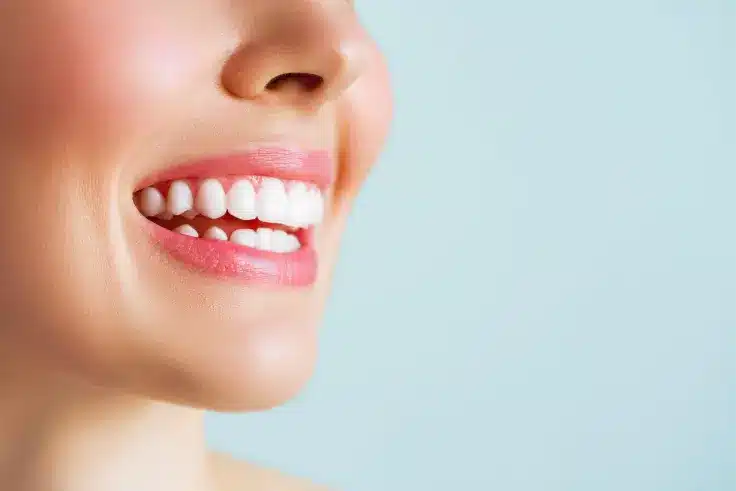 woman-smile https://www.dentalimplantscr.com/wp-content/uploads/2024/01/woman-smile.webp